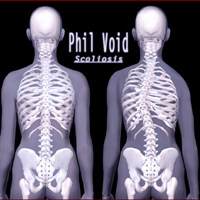 Phil Void - Scoliosis